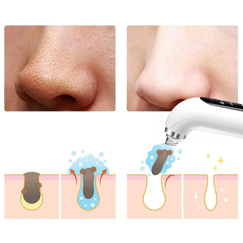 Skin Beauty™ 2.0 - Removedor de Cravos Elétrico - Minha loja